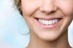 Get Whiter Teeth in Just a Few Days with Veneers